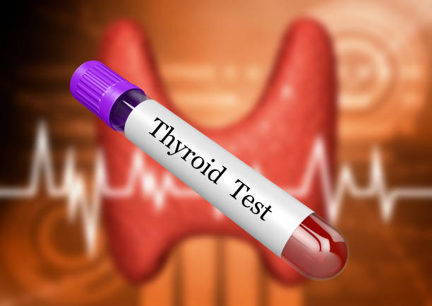 Measuring the active hormone T3 - Thyroid Test - Dragonfly Medspa