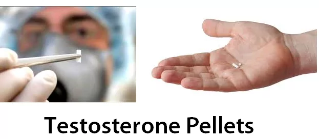 Testosterone Replacement Options - Testosterone Pellets - Long-Lasting and Low Risk